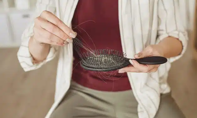 Como tratar la CAIDA del cabello