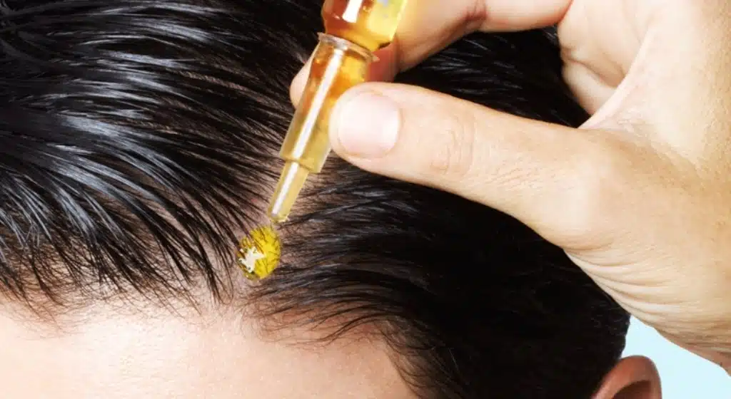 Cuidado del Cabello en Invierno: Consejos Esenciales