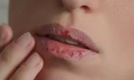 Cómo prevenir la deshidratación durante el ejercicio