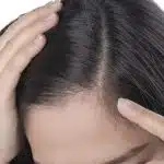 Importancia del Cuidado del Cuero Cabelludo: Clave para un Cabello Saludable