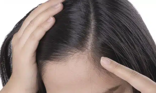 Importancia del Cuidado del Cuero Cabelludo: Clave para un Cabello Saludable